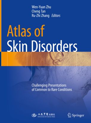 Atlas Of Skin Disorders 1st Ed Wenyuan Zhu Cheng Tan Ruzhi Zhang