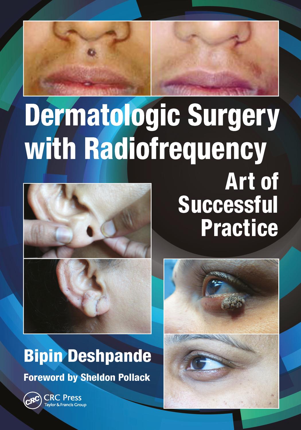 Dermatologic Surgery With Radiofrequency Art Of Successful Practice 1st Bipin Deshpande