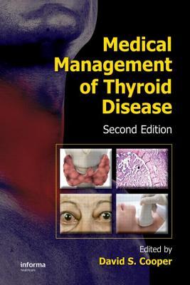 Medical Management Of Thyroid Disease Second Edition 2nd David S Coopereditor