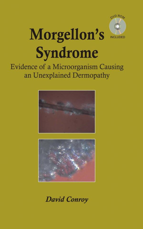 Morgellons Syndrome Evidence Of A Microorganism Causing An Unexplained Dermopathy Conroy
