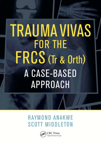 Trauma Vivas For The Frcs A Casebased Approach First Edition Anakwe