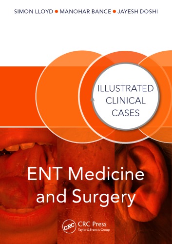 Ent Medicine And Surgery Illustrated Clinical Cases Lloyd Simon Kinglsey Wickham