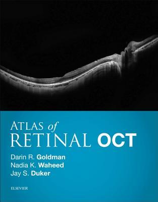 Atlas Of Retinal Oct Optical Coherence Tomography 1st Darin Goldman Nadia K Waheed Jay S Duker