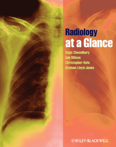 Radiology At A Glance Rajat Chowdhury Et Al