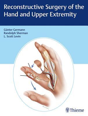 Reconstructive Surgery Of The Hand And Upper Extremity G Germann