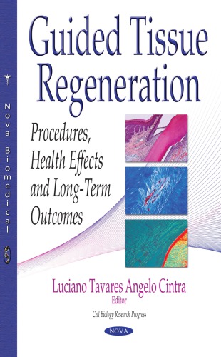 Guided Tissue Regeneration Angelo Cintra Luciano Tavares