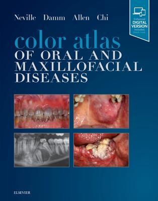 Color Atlas Of Oral And Maxillofacial Diseases Hardcover Brad W Neville
