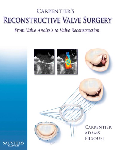 Carpentiers Reconstructive Valve Surgery 1st Edition Alain Carpentier