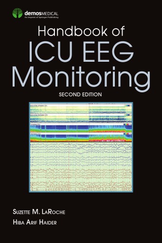 Handbook Of Icu Eeg Monitoring 2nd Edition Suzette Laroche Hiba Haider