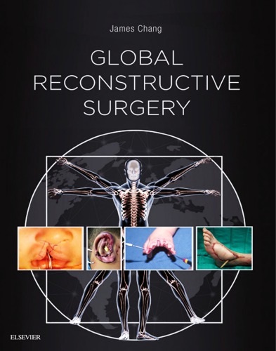 Global Reconstructive Surgery James Chang