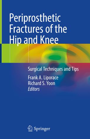 Periprosthetic Fractures Of The Hip And Knee Surgical Techniques And Tips 1st Ed Frank A Liporace