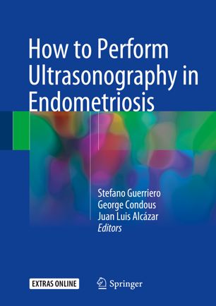 How To Perform Ultrasonography In Endometriosis 1st Ed Stefano Guerriero