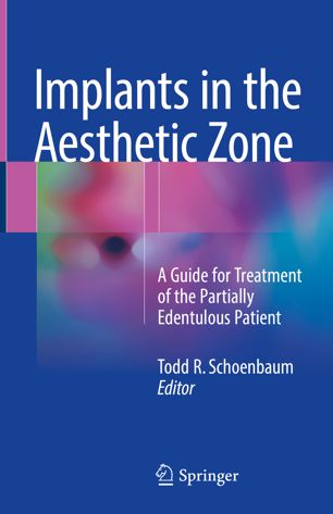 Implants In The Aesthetic Zone A Guide For Treatment Of The Partially Edentulous Patient 1st Ed Todd R Schoenbaum