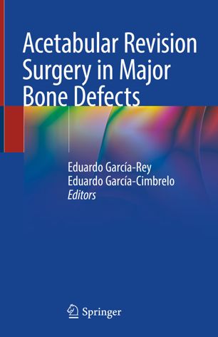 Acetabular Revision Surgery In Major Bone Defects 1st Ed Eduardo Garcarey