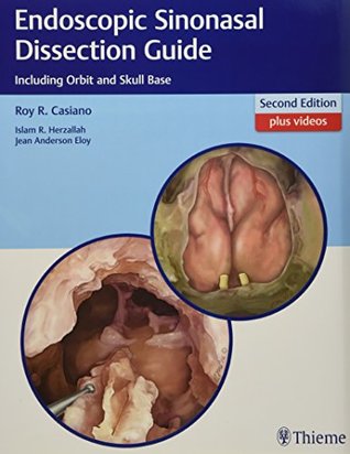 Endoscopic Sinonasal Dissection Guide Including Orbit And Skull Base 2nd Roy R Casiano Islam R Herzallah Jean Anderson Eloy
