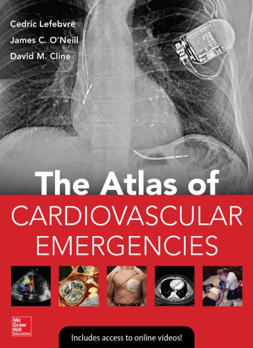 Atlas Of Cardiovascular Emergencies 1st Edition Cedric Lefebvre