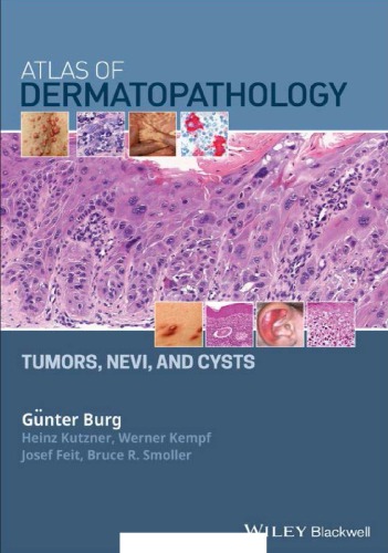 Atlas Of Dermatopathology Tumors Nevi And Cysts Burg Gnter Feit