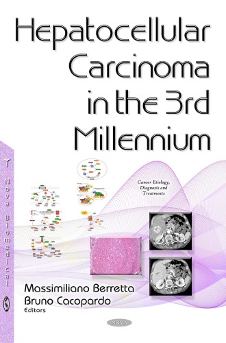 Hepatocellular Carcinoma In The 3rd Millennium Massimiliano Berretta