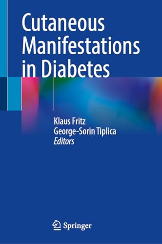 Cutaneous Manifestations In Diabetes 2024th Edition Klaus Fritz
