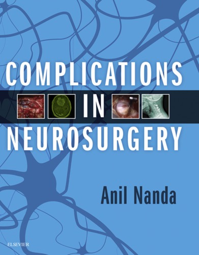Complications In Neurosurgery 1st Edition Anil Nanda