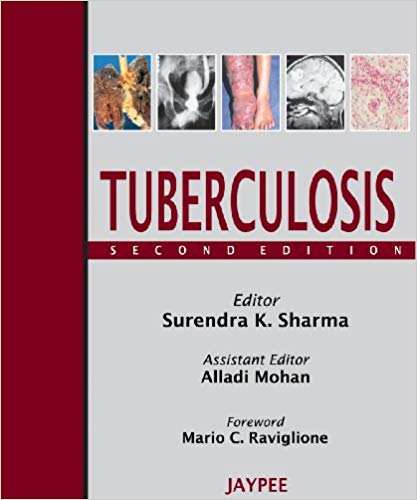 Tuberculosis 2nd Edition Sharma