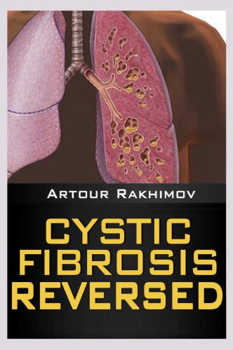 Cystic Fibrosis Life Expectancy 30 50 70 Health Fitness And Dieting Childrens Health Cystic Fibrosis Book 1 Artour Rakhimov