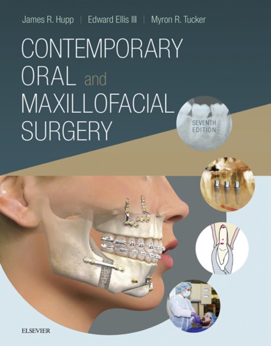 Contemporary Oral And Maxillofacial Surgery 7th Edition James Hupp
