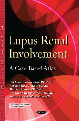 Lupus Renal Involvement A Casebased Atlas Gyl Eanes Barros Silva