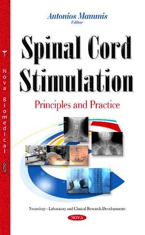 Spinal Cord Stimulation Hardcover Antonios Mammis