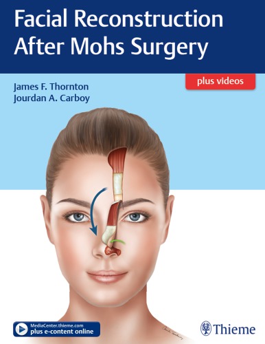 Facial Reconstruction After Mohs Surgery James F Thornton Jourdan A Carboy