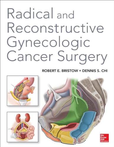 Radical And Reconstructive Gynecologic Cancer Surgery Robert E Bristow