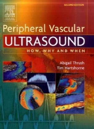 Peripheral Vascular Ultrasound How Why And When 2nd Ed Abigail Thrush
