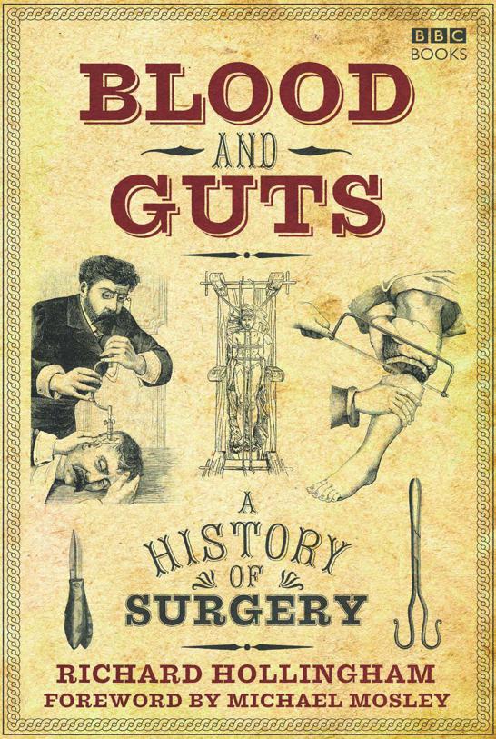 Blood And Guts A History Of Surgery Richard Hollingham