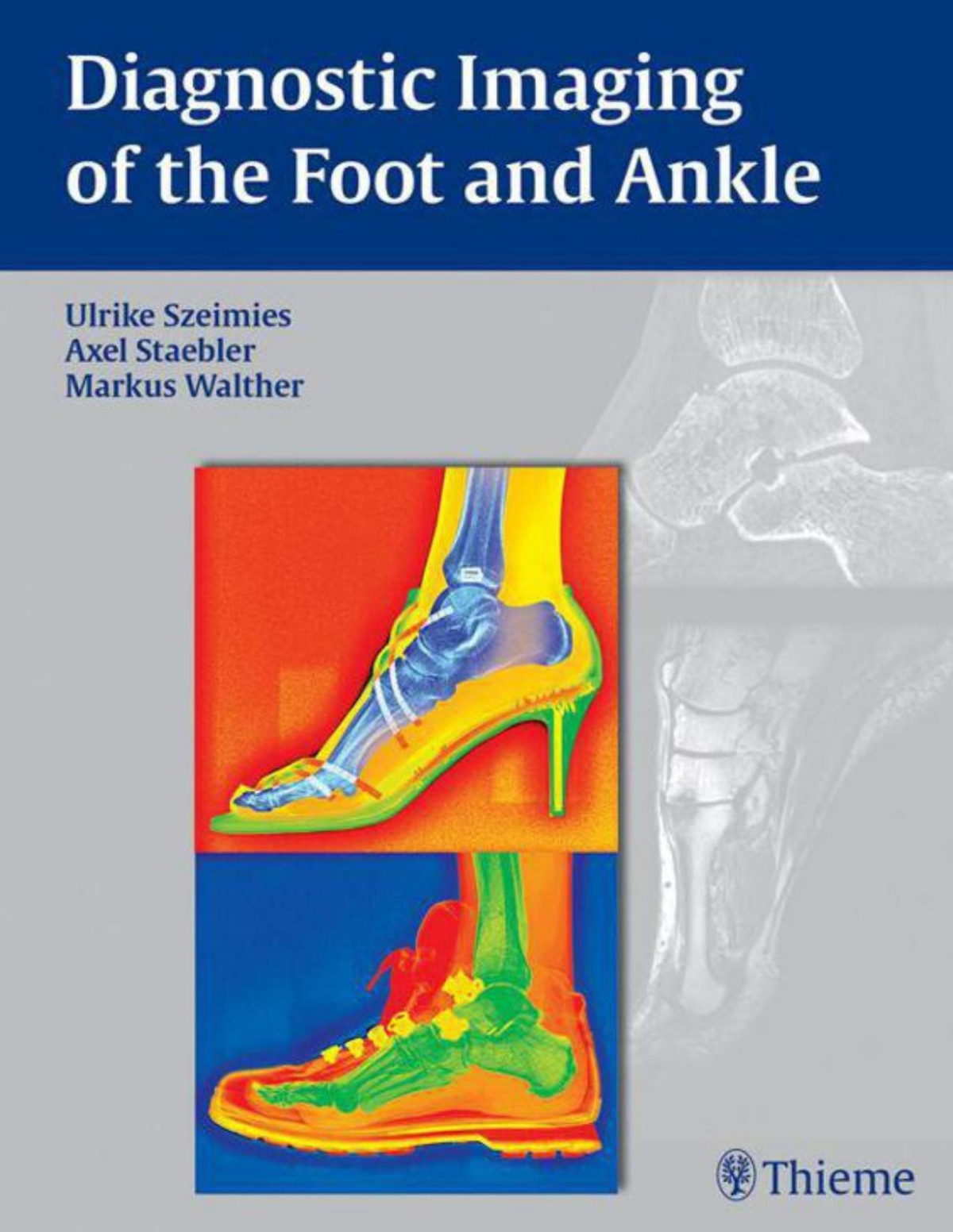 Diagnostic Imaging Of The Foot And Ankle Ulrike Szeimies Axel Stbler Markus Walther