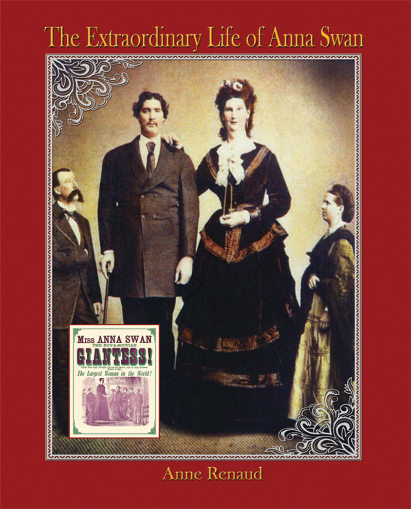 The Extraordinary Life Of Anna Swan Renaud Anne