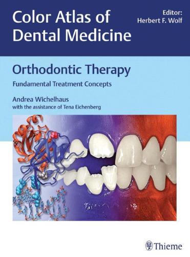 Orthodontic Therapy Fundamental Treatment Concepts Color Atlas Of Dental Medicine Andrea Wichelhaus