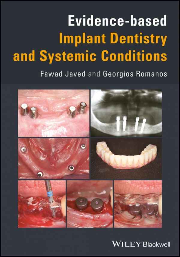 Evidencebased Implant Dentistry And Systemic Conditions Javed