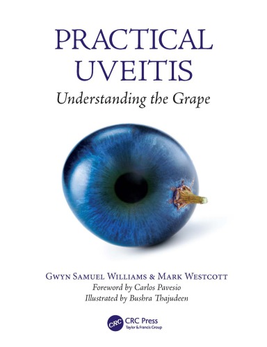 Practical Uveitis Westcott Mark K Williams Gwyn