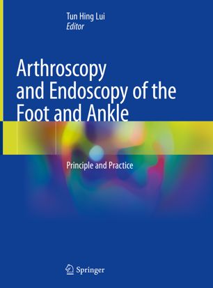 Arthroscopy And Endoscopy Of The Foot And Ankle Principle And Practice 1st Ed Tun Hing Lui