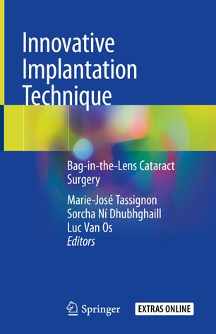 Innovative Implantation Technique Baginthelens Cataract Surgery 1st Ed Mariejos Tassignon