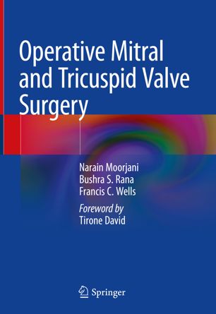 Operative Mitral And Tricuspid Valve Surgery 1st Ed Narain Moorjani