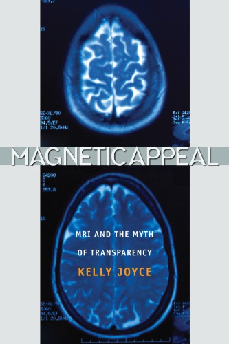 Magnetic Appeal Mri And The Myth Of Transparency Kelly A Joyce