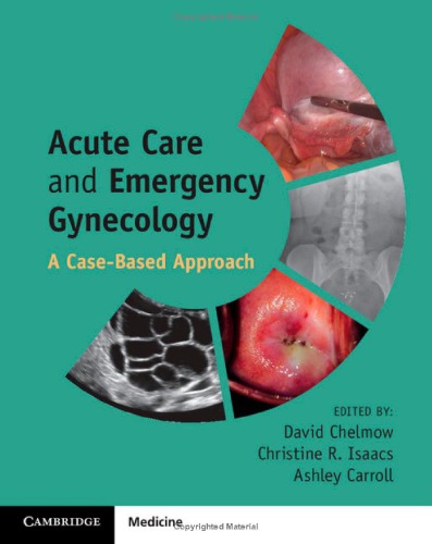 Acute Care And Emergency Gynecology A Casebased Approach David Chelmow