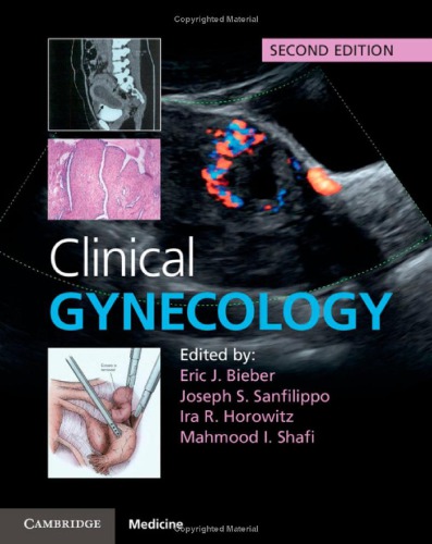 Clinical Gynecology 2nd Edition Eric J Bieber Joseph S Sanfilippo