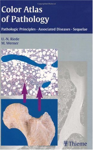 Color Atlas Of Pathology Pathologic Principles Associated Diseases Sequela 1st Edition Ursusnikolaus Riede