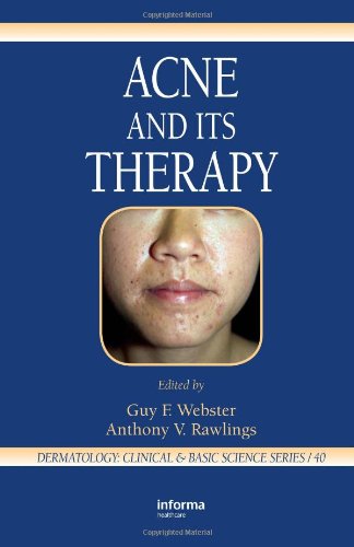 Acne And Its Therapy 1st Edition Guy F Webster Anthony V Rawlings