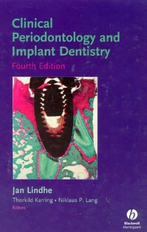 Clinical Periodontology And Implant Dentistry 4th Jan Lindhe