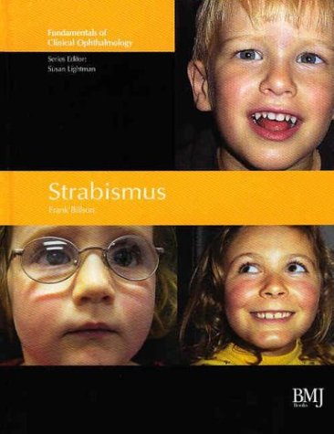 Strabismus Fundamentals Of Clinical Opthalmology 1st Edition Frank Billson