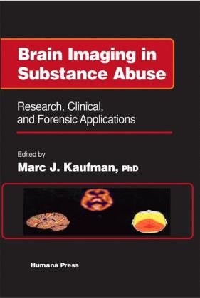 Brain Imaging In Substance Abuse Research Clinical And Forensic Applns 1st Marc J Kaufman