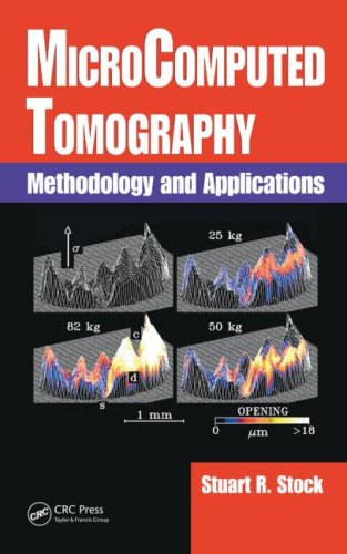 Microcomputed Tomography Methodology And Applications 1st Edition Stuart R Stock